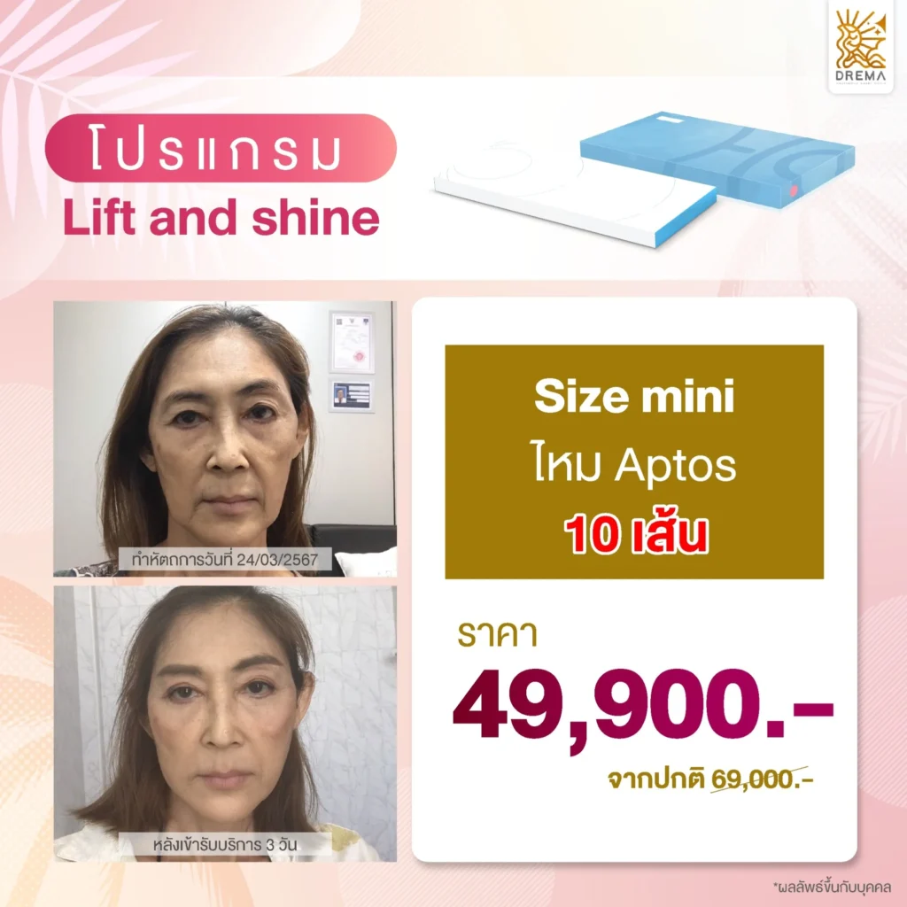 โปรแกรมร้อยไหม