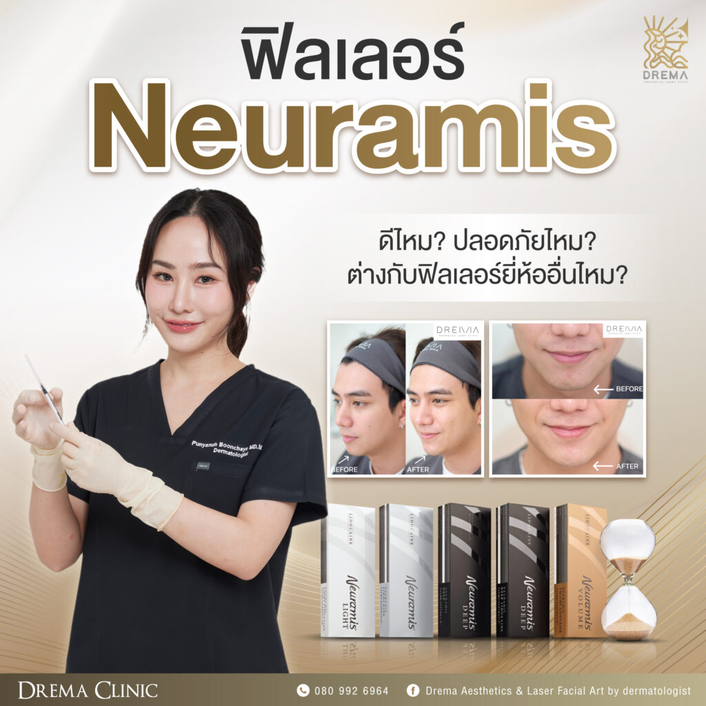 ฟิลเลอร์ Neuramis ดีไหม ปลอดภัยไหม ต่างกับฟิลเลอร์ยี่ห้ออื่นไหม