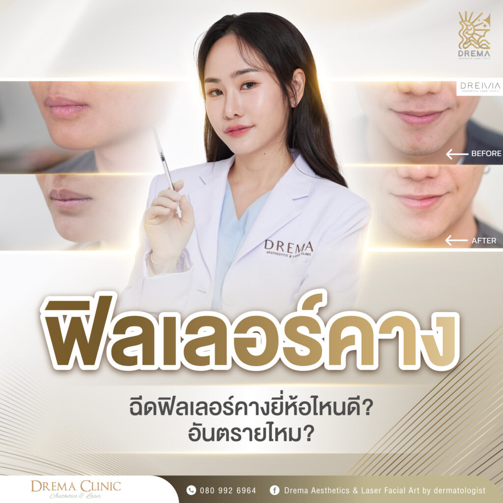  ฟิลเลอร์คาง ฉีดฟิลเลอร์คางยี่ห้อไหนดี อันตรายไหม