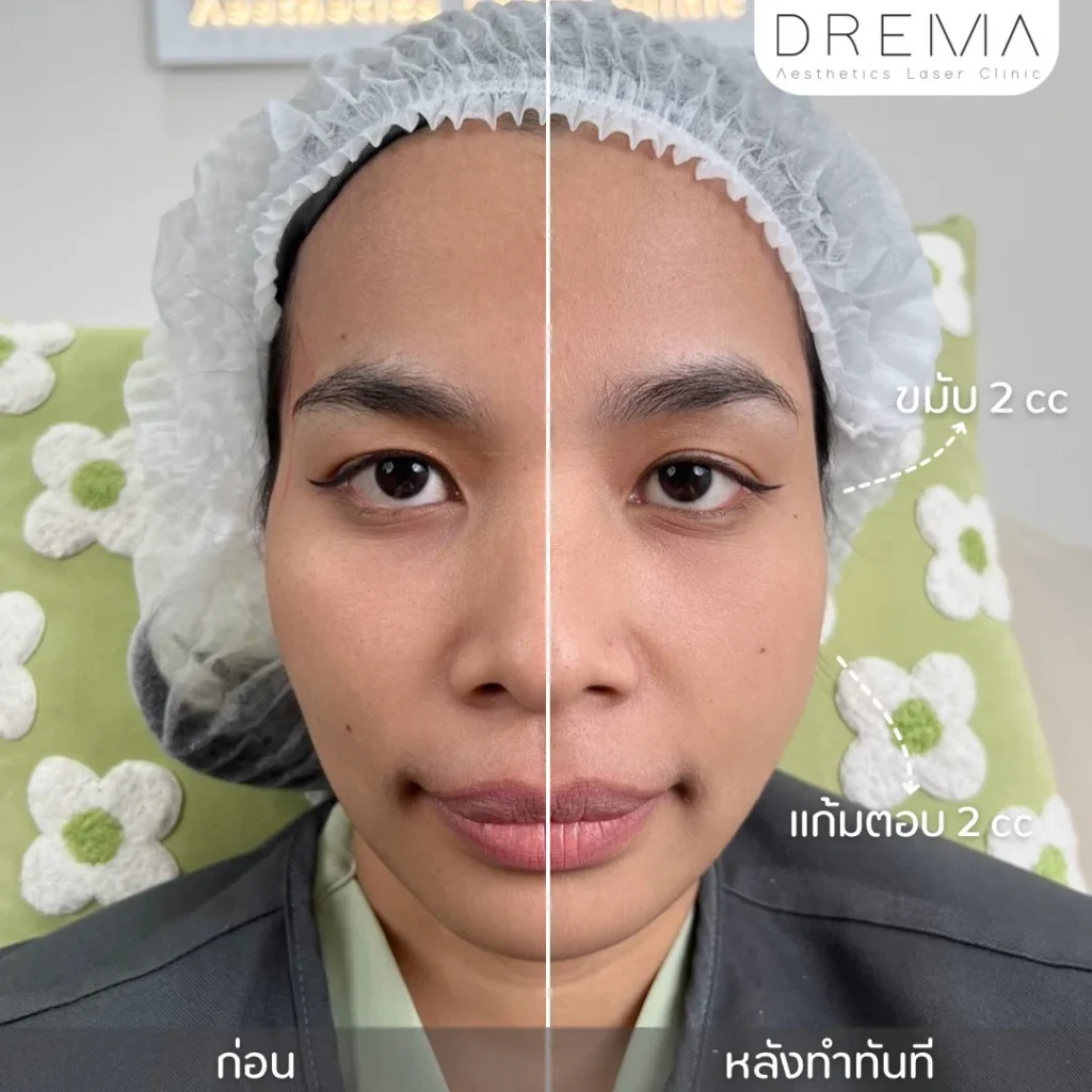 แก้มตอบ